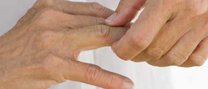 Fingerschmerzen